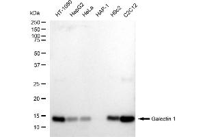 Western blotting analysis using Galectin 1 antibody (ABIN7799242). (Recombinant LGALS1/Galectin 1 抗体)