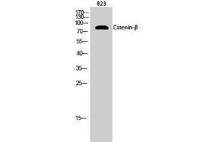Western Blotting (WB) image for anti-Catenin, beta (CATNB) (Ser289) antibody (ABIN3183683) (beta Catenin 抗体  (Ser289))