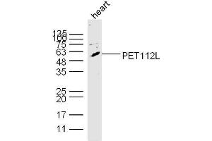 Mouse heart lysates probed with PET112L Polyclonal Antibody, unconjugated  at 1:300 overnight at 4°C followed by a conjugated secondary antibody at 1:10000 for 60 minutes at 37°C. (PET112L 抗体  (AA 101-200))