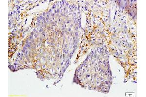 Formalin-fixed and paraffin embedded rat skin labeled with Anti-MIF Polyclonal Antibody, Unconjugated (ABIN736836) at 1:200 followed by conjugation to the secondary antibody and DAB staining. (MIF 抗体  (AA 51-115))