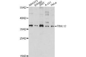 Western blot analysis of extracts of various cell lines, using FBXL12 antibody (ABIN6292081) at 1:1000 dilution.