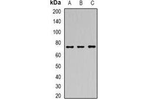 Western blot analysis of SAMHD1 expression in Hela (A), MCF7 (B), mouse spleen (C) whole cell lysates. (SAMHD1 抗体)