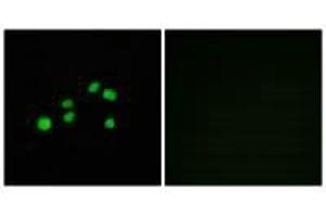 Immunofluorescence (IF) image for anti-Collagen, Type XXIII, alpha 1 (COL23A1) antibody (ABIN7183374)