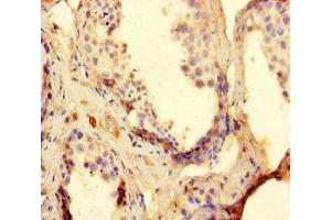 Immunohistochemistry of paraffin-embedded human testis tissue using ABIN7166671 at dilution of 1:100 (TDRD9 抗体  (AA 286-585))