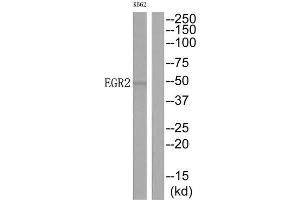 Western Blotting (WB) image for anti-Early Growth Response 2 (EGR2) (C-Term) antibody (ABIN1849150) (EGR2 抗体  (C-Term))