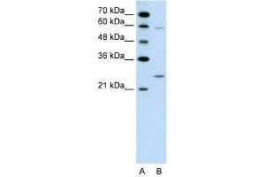 WB Suggested Anti-GAMT  Antibody Titration: 0. (GAMT 抗体  (N-Term))