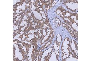 IHC analysis of WDR44 using anti-WDR44 antibody (ABIN7600394). (WDR44 抗体  (AA 188-913))