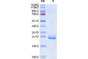 SDS-PAGE (SDS) image for delta Like Protein 3 (DLL3) (AA 27-215) protein (His-DYKDDDDK Tag) (ABIN7274484)