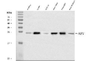 Western blot analysis of Aquaporin 2 using anti-Aquaporin 2 antibody (ABIN3043788).