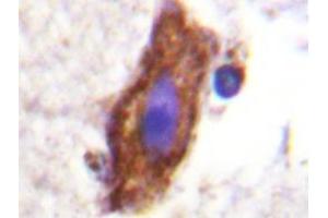 Immunohistochemistry analyzes of AP20219PU-N CSFR antibody in paraffin-embedded human brain tissue. (CSF1R 抗体)
