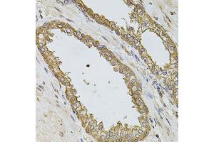 Immunohistochemistry of paraffin-embedded human prostate using PIK3CA antibody. (PIK3CA 抗体)