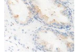 IHC-P analysis of Human Prostate Gland Tissue, with DAB staining. (Kallikrein 11 抗体  (AA 39-282))