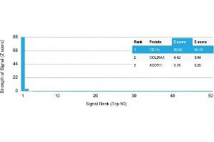 Analysis of Protein Array containing >19,000 full-length human proteins using CD11c Mouse Monoclonal Antibody (ITGAX/2507) Z- and S- Score: The Z-score represents the strength of a signal that a monoclonal antibody (Monoclonal Antibody) (in combination with a fluorescently-tagged anti-IgG secondary antibody) produces when binding to a particular protein on the HuProtTM array. (CD11c 抗体  (AA 637-827))