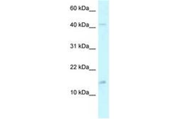 PCBD2 anticorps  (AA 71-120)