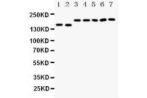 Western Blotting (WB) image for anti-Deleted in Colorectal Carcinoma (DCC) (AA 162-178), (N-Term) antibody (ABIN3044119)