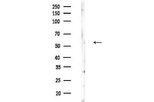 anti-Solute Carrier Family 22 Member 6 (SLC22A6) (C-Term) antibody