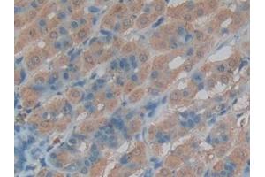 Used in DAB staining on fromalin fixed paraffin- embedded stomach tissue (Cathepsin L 抗体  (AA 114-288))