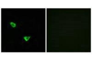 Immunofluorescence analysis of MCF-7 cells, using CHSS2 antibody. (CHPF 抗体)