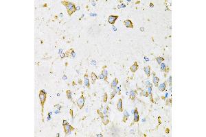 Immunohistochemistry of paraffin-embedded Mouse brain using ADIPOQ antibody (ABIN3016228, ABIN3016229, ABIN3016230 and ABIN6219638) at dilution of 1:100 (40x lens). (ADIPOQ 抗体  (AA 19-104))