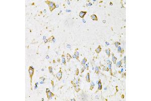 Immunohistochemistry of paraffin-embedded Mouse brain using ADIPOQ antibody (ABIN3016228, ABIN3016229, ABIN3016230 and ABIN6219638) at dilution of 1:100 (40x lens). (ADIPOQ 抗体  (AA 19-104))