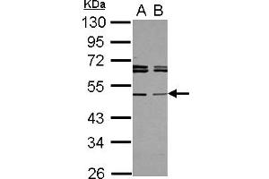 Western Blotting (WB) image for anti-TAP Binding Protein-Like (TAPBPL) (AA 140-399) antibody (ABIN1501298) (TAPBPL 抗体  (AA 140-399))