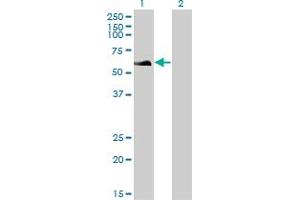 Western Blot analysis of RAD18 expression in transfected 293T cell line by RAD18 monoclonal antibody (M01), clone 3H7. (RAD18 抗体  (AA 332-430))