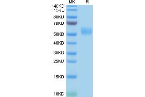 Human SIRP Beta on Tris-Bis PAGE under reduced conditions. (SIRP-beta Protein (AA 30-369) (His-Avi Tag))