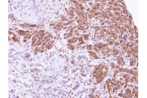 IHC-P Image Immunohistochemical analysis of paraffin-embedded SAS xenograft , using MTAP, antibody at 1:500 dilution. (MTAP 抗体)
