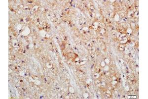 Formalin-fixed and paraffin embedded mouse brain labeled with Rabbit Anti-PLDL1 Polyclonal Antibody, Unconjugated (ABIN754588) at 1:200 followed by conjugation to the secondary antibody and DAB staining (PLCL1 抗体  (AA 1001-1096))
