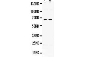 Western blot analysis of CCDC6 expression in rat testis extract ( Lane 1) and MCF-7 whole cell lysates ( Lane 2). (CCDC6 抗体  (N-Term))