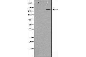 Western blot analysis of extracts of A431 , using TP53BP1 antibody.