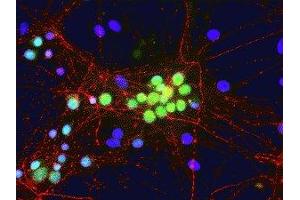 Immunofluorescence of cultured rat neurons showing nuclear and distal cytoplasmic staining of FOX1 in green. (A2BP1 抗体  (N-Term))