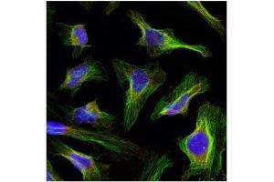 Image no. 2 for anti-B-Cell CLL/lymphoma 2 (BCL2) (AA 54-58) antibody (ABIN197202) (Bcl-2 抗体  (AA 54-58))