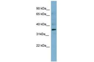 Image no. 2 for anti-Mesothelin (MSLN) (AA 395-444) antibody (ABIN6741693) (Mesothelin 抗体  (AA 395-444))