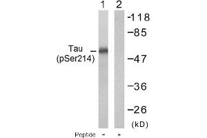 Image no. 1 for anti-Microtubule-Associated Protein tau (MAPT) (pSer214) antibody (ABIN196804) (MAPT 抗体  (pSer214))