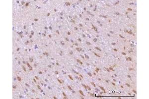 IHC analysis of RIMBP2 using anti-RIMBP2 antibody (ABIN7601441). (RIMBP2 抗体  (AA 351-1049))