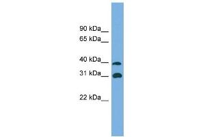 WB Suggested Anti-CRYM Antibody Titration: 0. (CRYM 抗体  (Middle Region))