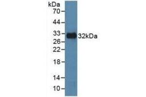 Detection of Recombinant MAPK8, Human using Polyclonal Antibody to c-Jun N-terminal Kinase 1 (JNK1) (C-Jun N-Terminal Kinases (AA 145-419) 抗体)