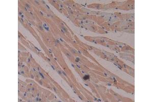 IHC-P analysis of Human Tissue, with DAB staining. (CKMT2 抗体  (AA 40-419))
