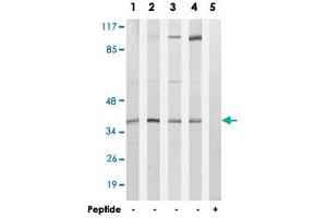 Western blot analysis of extracts from LoVo cells (Lane 1 and lane 5), A-549 cells (Lane 2), HUVEC cells (Lane 3) and MCF-7 cells (Lane 4), using HOXB2 polyclonal antibody .