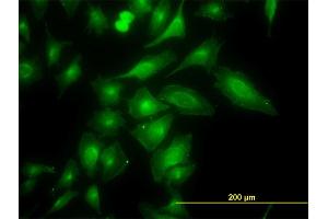 Immunofluorescence of monoclonal antibody to TRAPPC4 on HeLa cell. (TRAPPC4 抗体  (AA 1-219))