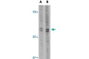 Western blot analysis of Trim30 in mouse heart tissue lysate with Trim30 polyclonal antibody  at (A) 1 and (B) 2 ug/mL . (TRIM30 抗体  (N-Term))