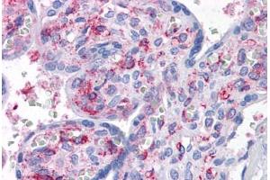 Human Placenta: Formalin-Fixed, Paraffin-Embedded (FFPE) (CAB39L 抗体  (AA 1-367))