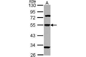 WB Image Sample (30 ug of whole cell lysate) A: Hep G2 , 10% SDS PAGE antibody diluted at 1:1000 (SERPINA1 抗体  (Center))