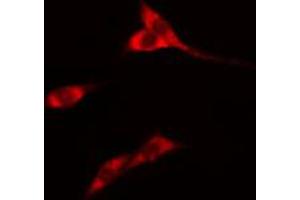 ABIN6274564 staining Hela cells by IF/ICC. (14-3-3 eta 抗体  (Internal Region))