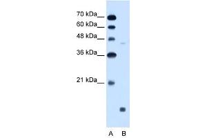 EDG8 antibody used at 0. (S1PR5 抗体  (N-Term))
