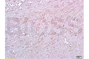 Formalin-fixed and paraffin embedded rat brain tissue labeled with :  Anti-5-HTR2A Polyclonal Antibody, unconjugated (ABIN737016)  at 1: 200 followed by incubation with conjugated secondary antibody and DAB staining (HTR2A 抗体  (AA 65-160))