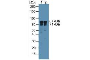 Western blot analysis of (1) Human A549 Cells and (2) Human Liver Tissue. (Integrin beta 3 抗体  (AA 135-377))