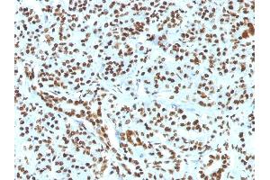Formalin-fixed, paraffin-embedded human Pancreas stained with Histone H1 Rabbit Recombinant Monoclonal Antibody (HH1/1784R). (Recombinant Histone H1 抗体)