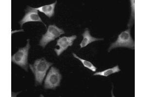 Immunofluorescent staining of A549 (ATCC CCL-185) cells. (CAMP-Dependent Protein Kinase R1 (PKA-R1) (AA 225-381) 抗体)
